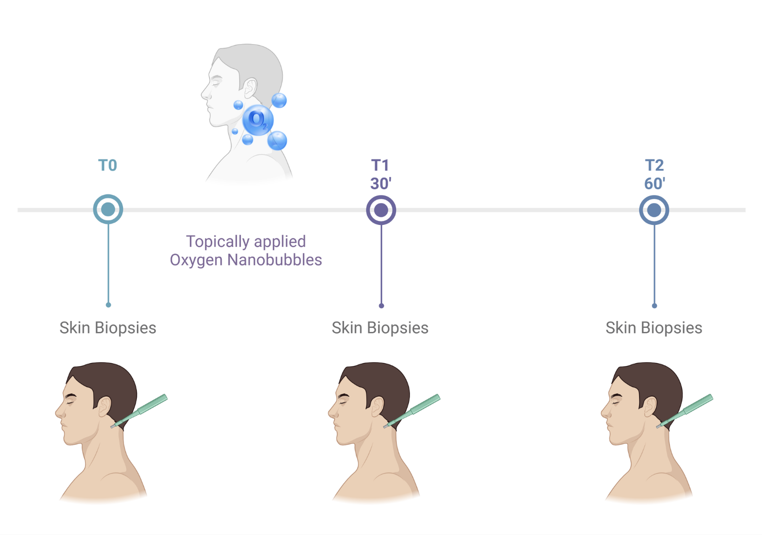 Study design and biopsy site diagram