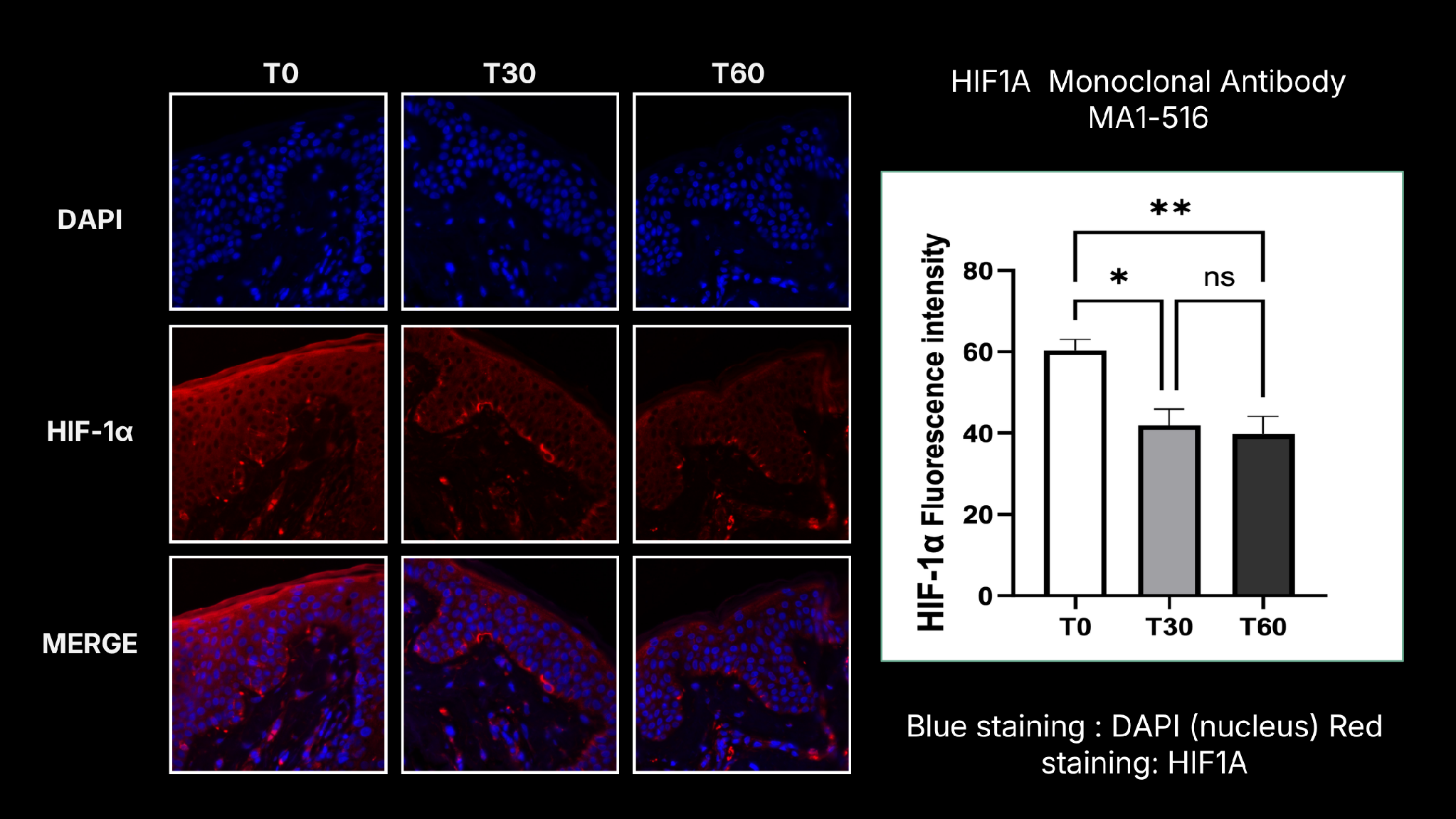 HIF-1α immunofluorescence results at T0, T30, T60