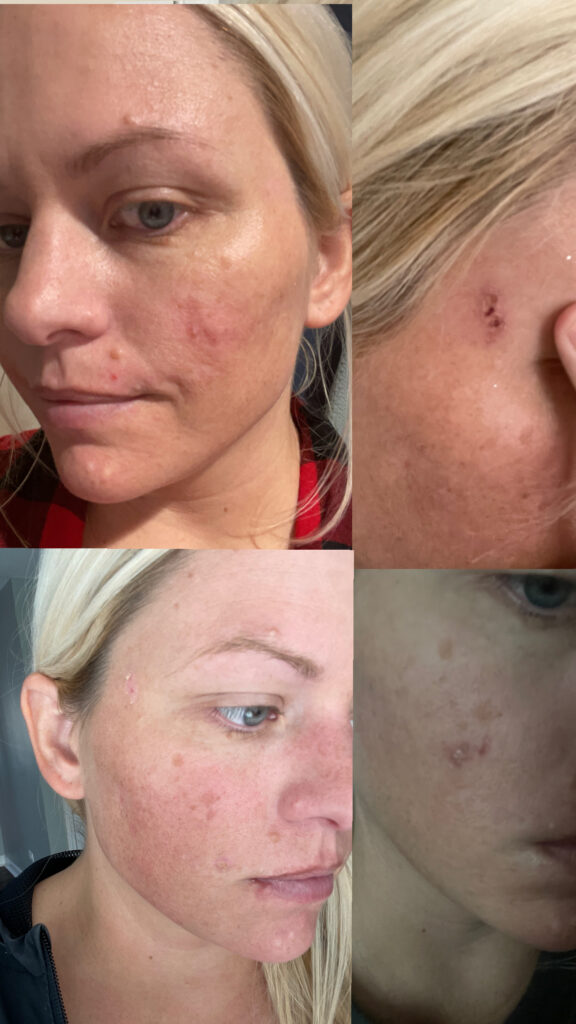 Image #2 from Ashley Iovinelli