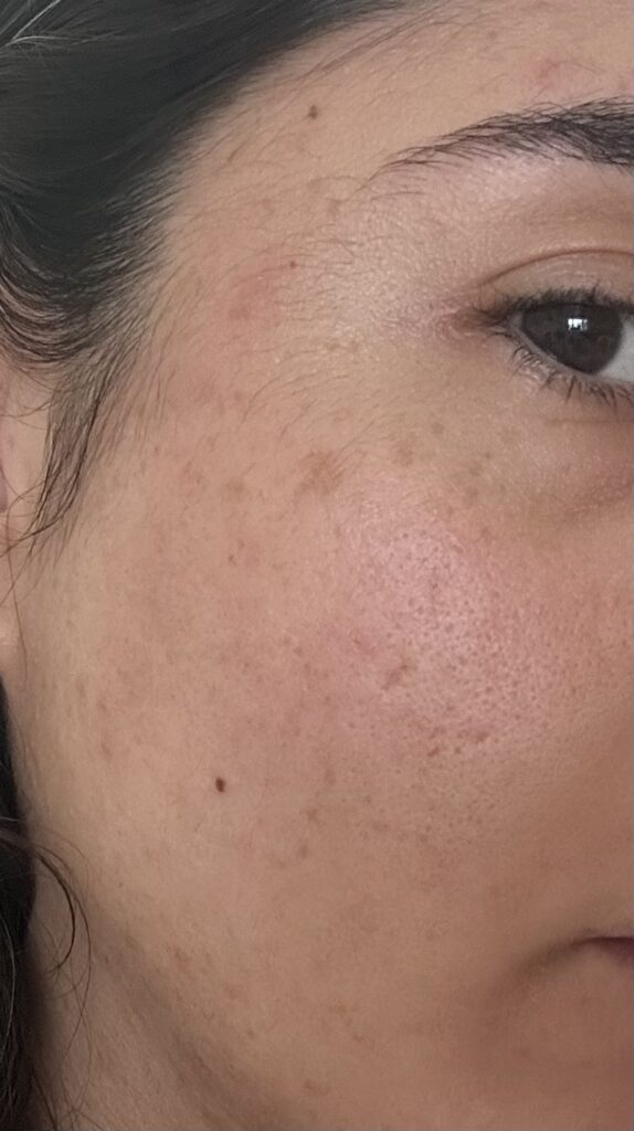 Image #2 from Isabella M