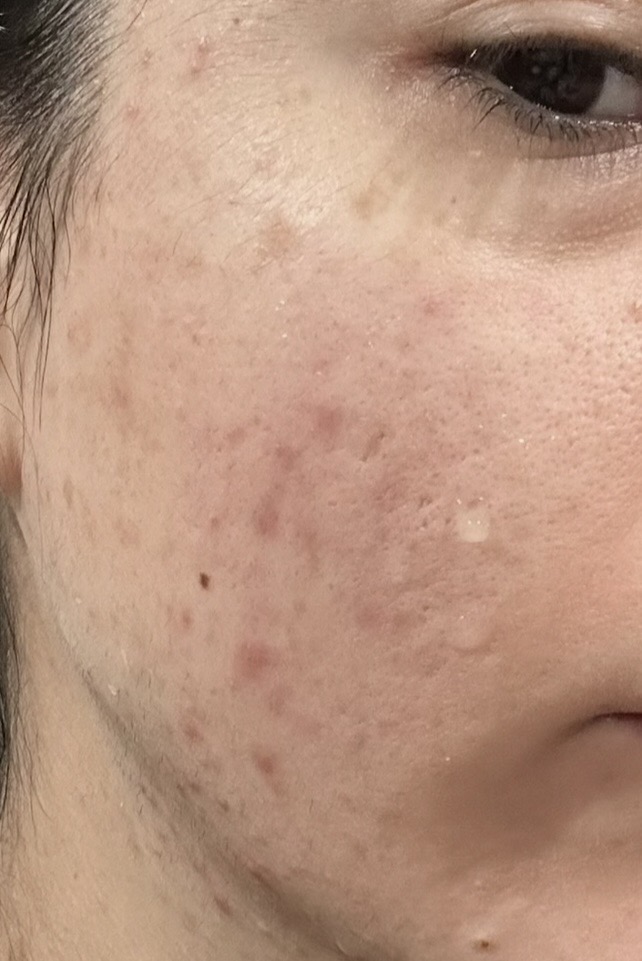 Image #1 from Isabella M