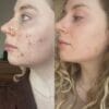 A02 Clear Results in just 8 Weeks A02 Clear Results in just 8 Weeks