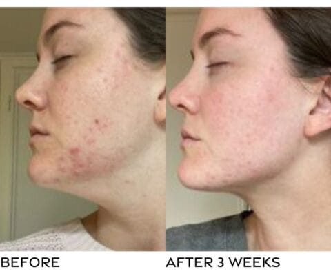 Ao2 J Reasons to Try - AO2 Clear Oxygen nanobubble technology for healthier skin