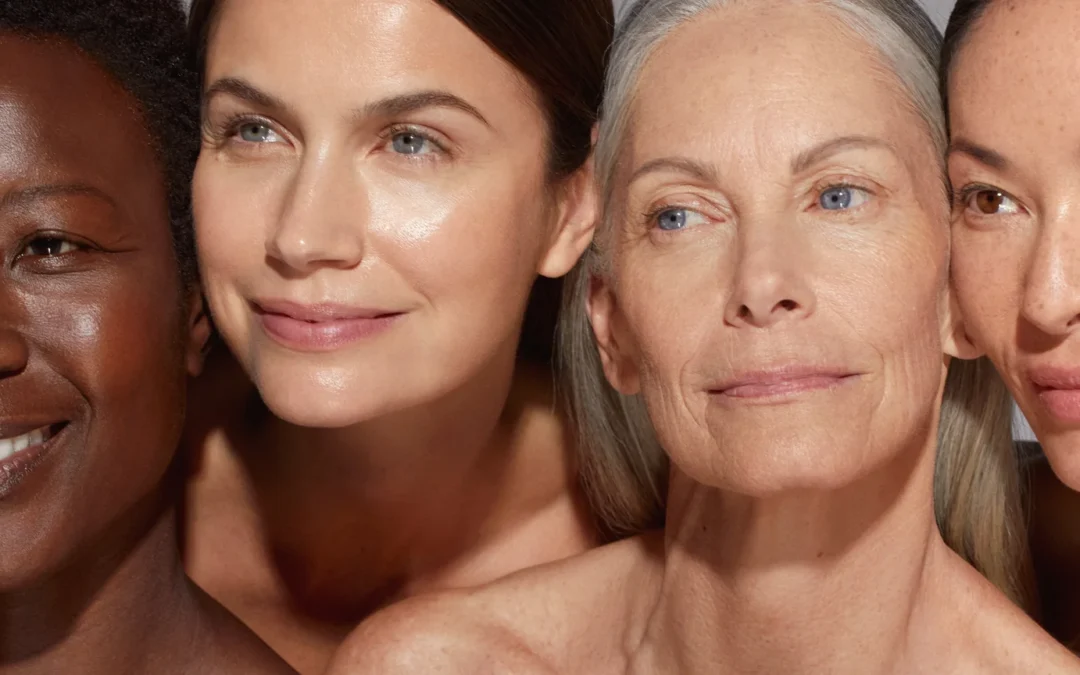 Post menopausal skin cystic breakouts treatment with barrier support