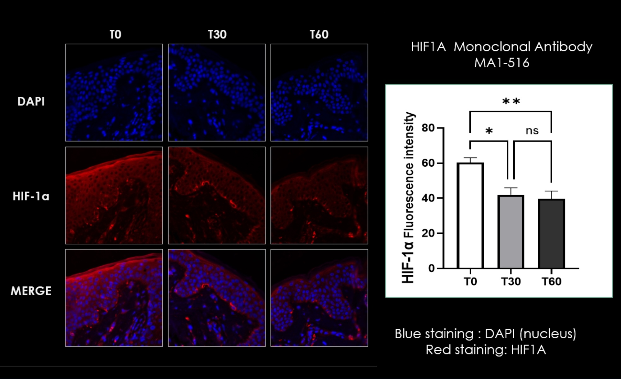 HIF-1α immunofluorescence at T0, T30, and T60 showing reduction in expression